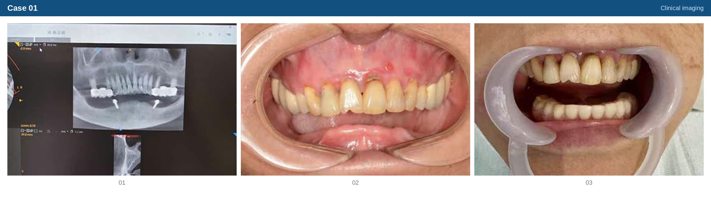 Clinical imaging case 01