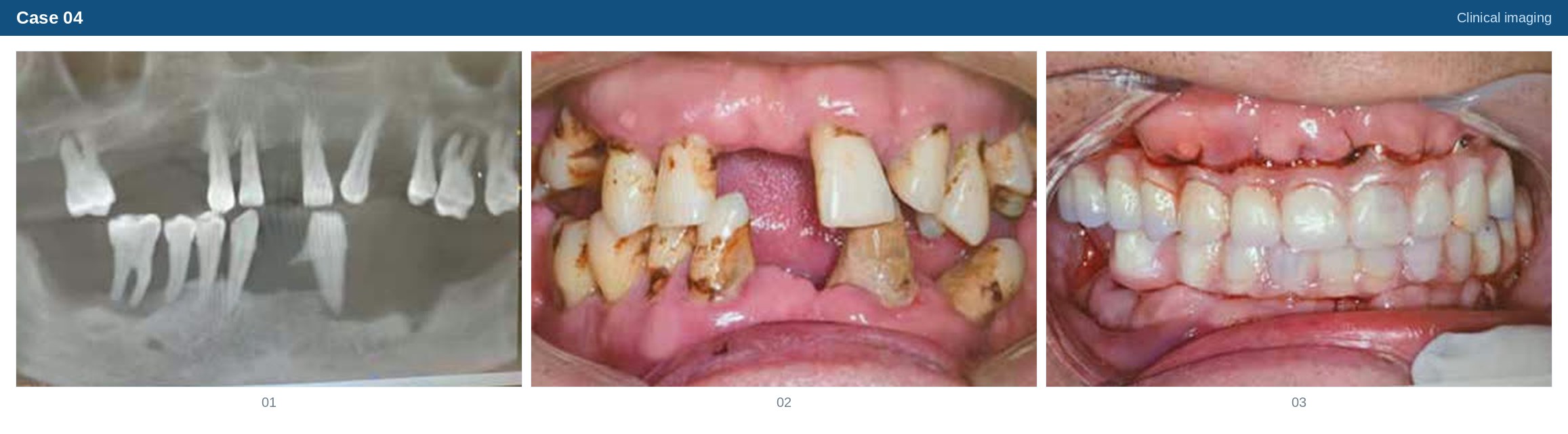 Clinical imaging case 04