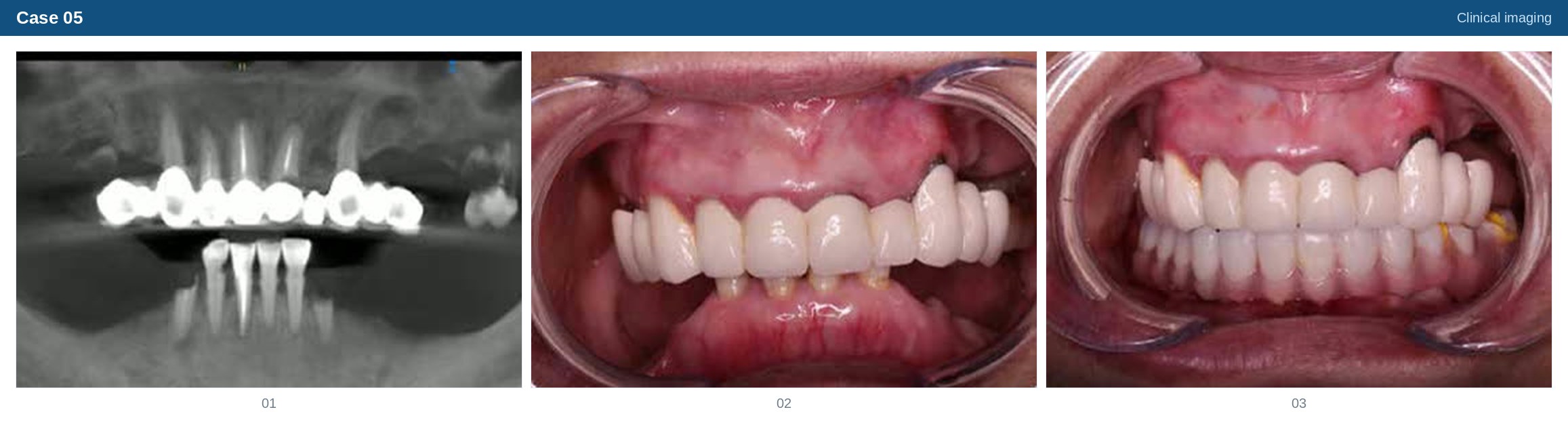 Clinical imaging case 05