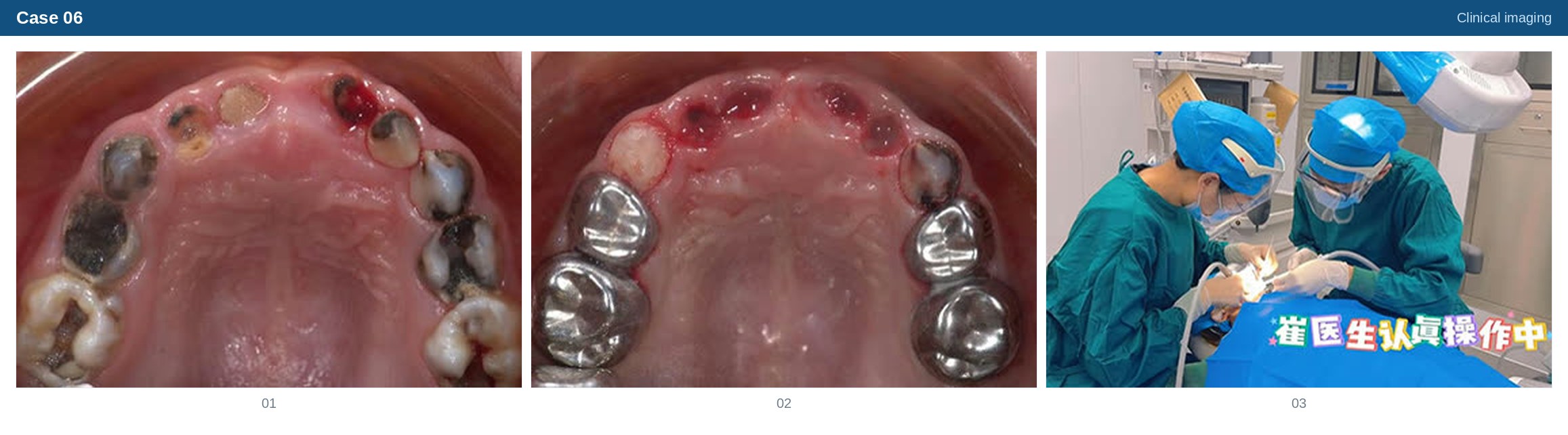 Clinical imaging case 06