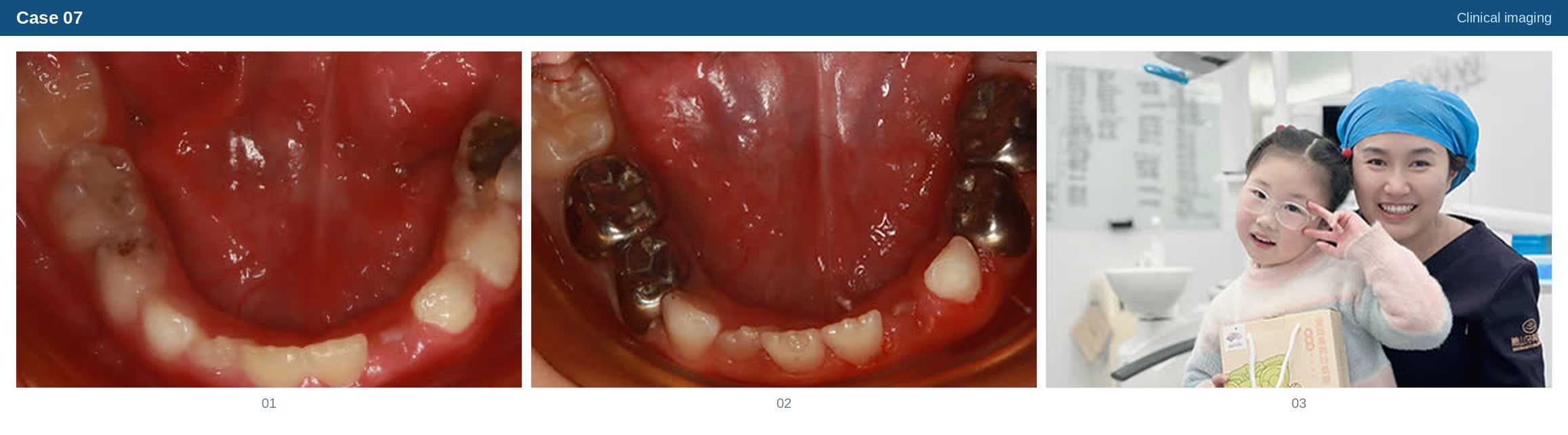 Clinical imaging case 07