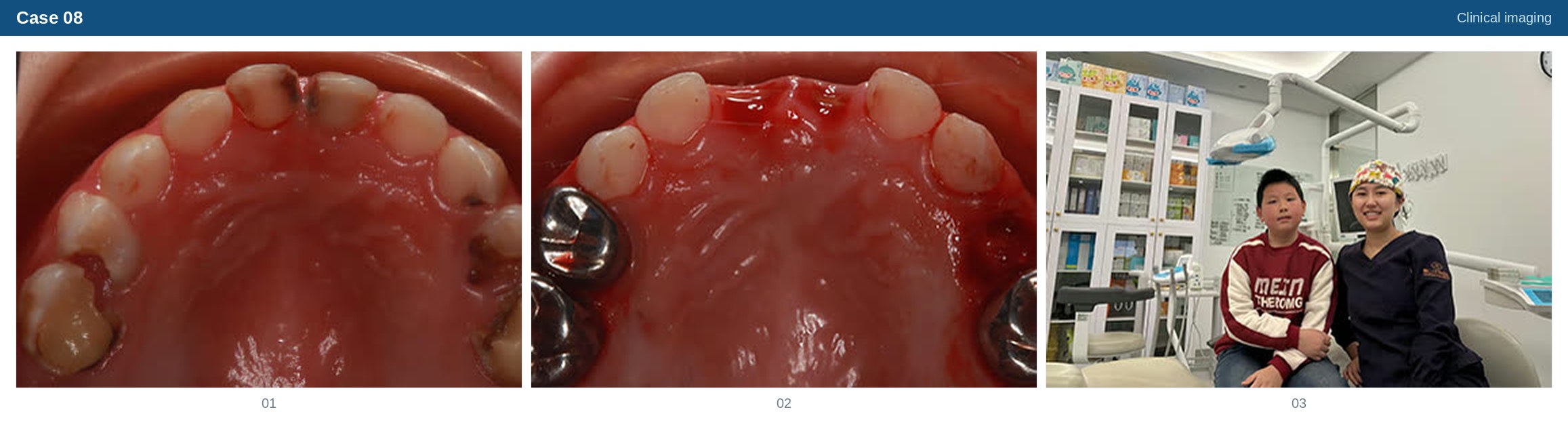 Clinical imaging case 08